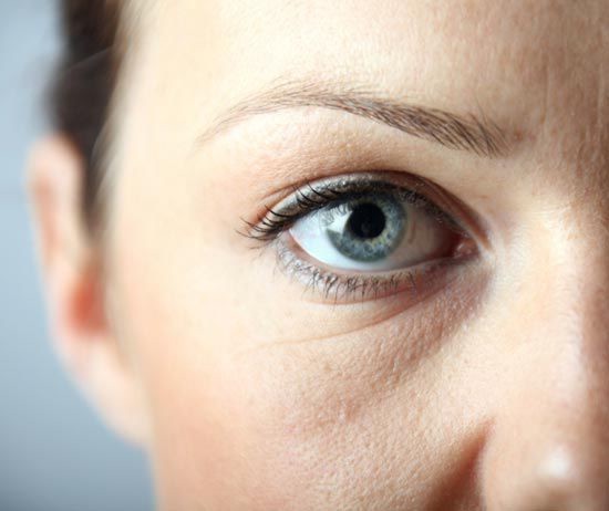 «Мешки»под глазами, отечность