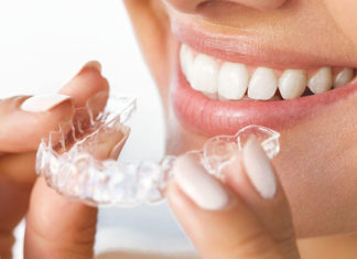Выбираем элайнеры для красивой улыбки