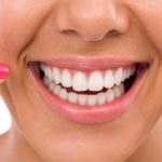 Качественная имплантация в Москве