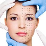 Все, что нужно знать о плазмолифтинге