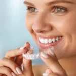 Элайнеры: как они работают