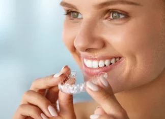 Элайнеры: как они работают