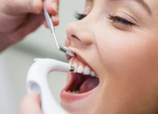 Профессиональная чистка зубов: как часто проводить