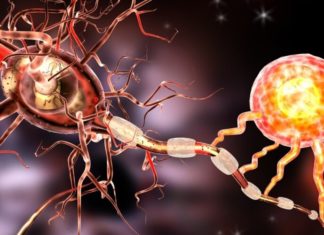 Рассеянный склероз: как проявляется