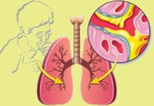 Как бороться с мокротой: советы