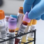 Анализ крови на сифилис: как часто нужно сдавать