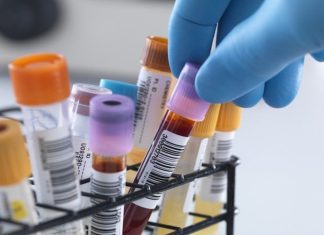 Анализ крови на сифилис: как часто нужно сдавать