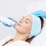 Игольчатый RF-лифтинг Vivace: инновационная процедура для упругости и молодости кожи