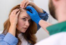 Лечение перхоти и себорейного дерматита: современные подходы к терапии