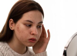 Прыщ на лбу в центре: примета или миф?