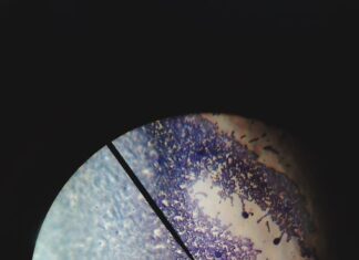 Синастрия: Юпитер в квадрате с Луной