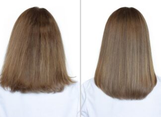 Заголовок: «Изменения в густоте волос: до и после»